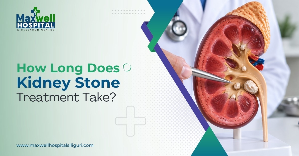 How Long Does Kidney Stone Treatment Take?