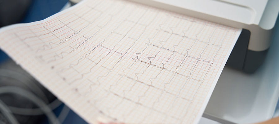 Cardiology Tests