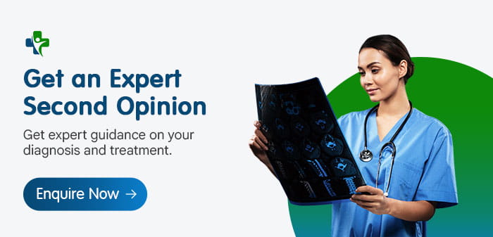 Second Opinion
