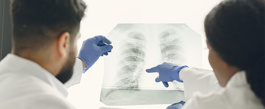 Tuberculosis tb Doctor in Siliguri