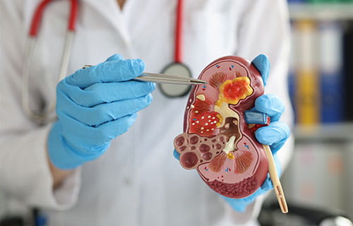 Nephrology